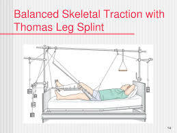 Combination of skeletal traction and balanced suspension is widely used for the treatment of fractures of the femoral shaft. Ppt Chapter 67 Musculoskeletal Care Modalities Powerpoint Presentation Id 1358081