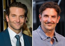 People Think Bradley Cooper Got Cosmetic Surgery, And These Plastic  Surgeons Seem To Agree