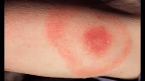 Pin On Fleas