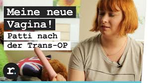 So dürfen nur bilder von eingriffen gezeigt werden, die rekonstruktiver natur und damit medizinisch indiziert sind. Meine Neue Vagina Patti Nach Der Transgender Op Reporter Youtube