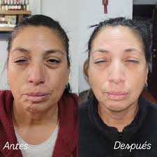 Kinesiólogo Ian Soto ⚕️♻️ (@kine.ian) • Instagram photos and videos