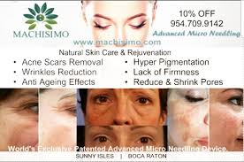 WHAT IS SCALP MICRO-PIGMENTATION? By Mike Hen of The Machi…