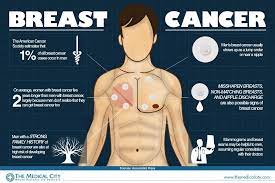 Men often discover changes to the nipple's appearance while showering or looking in a mirror. Breast Cancer In Men Edge Davao