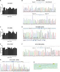 At the end of the pathology revision, study subjects were divided into four groups: High Incidence Of Somatic Bap1 Alterations In Sporadic Malignant Mesothelioma Sciencedirect