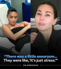 KimKardashian was diagnosed with a brain aneurysm due to "stress" possibly  caused by her divorce from Kanye West.⁠ Details:  https://www.suggest.com/kim-kardashian-kanye-west-divorce-medical-emergency/2901438/