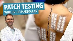 Image result for Patch Testing