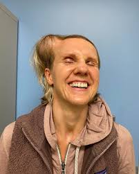 Well, dear friends, after 12 weeks of consistent trips down to Yale for  inflations to expand Corrina's scalp (390cc's total), we now stand