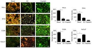 We did not find results for: 17b Estradiol Induced Mitochondrial Dysfunction And Warburg Effect In Cervical Cancer Cells Allow Cell Survival Under Metabolic Stress