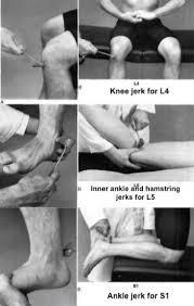 Image result for Reflex Exam