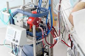 Ecmo stands for extracorporeal membrane oxygenation. What Is Ecmo Extracorporeal Membrane Oxygenation And How Is It Being Used To Help Severe Covid 19 Patients Abc News