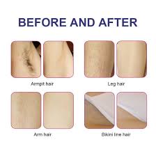 Since it specifically works on heating up the. Best Permanent Commercial Laser Hair Removal Instrument Price China Diode Laser Diode Laser Machine Made In China Com