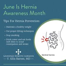 Image result for Hernia Reduction