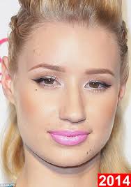 Doesnt even look like the same girl. Iggy Azalea Calls For More People To Be Honest About Cosmetic Surgery Daily Mail Online