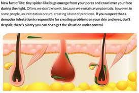 I was pretty sure that my conclusion would be that while demodex does not cause hair loss, it might be causing or exacerbating dandruff, itchiness, dryness or oiliness of the scalp. Home Demodex Hair Loss Causes Demodex Mites