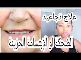 تخلصي من تجاعيد الابتسامة الحزينة تمارين بسيطة وسهلة ومضمونة مع خبيرة التجميل ميمي youtube