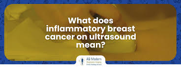 Image result for Inflammatory breast cancer