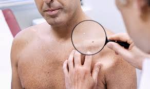 However, black men develop colon cancer at the highest rate among the ethnicities studied. Skin Cancer Symptoms Tumour Cases Rise Signs To Look Out For And How To Prevent It Express Co Uk
