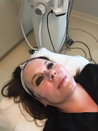 Tina Peeler, aesthetician at Luna Plastic Surgery, tries out the NEW  Societe Rejuvenating Peptide Mask after a Lumeca IPL treatment. Tina is a  big fan!