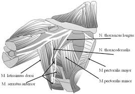 Image result for Intrapleural Anesthesia