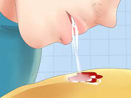 Check spelling or type a new query. 3 Ways To Get Out Blood Stains Wikihow