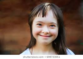 Is The Term Mongoloid Considered Racist By Many People Quora