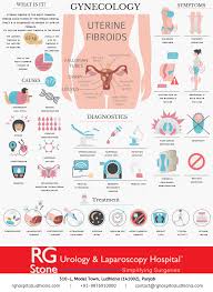 How do i find out if i have uterine fibroids? Gynecology Uterine Fibroids Symptoms Causes Diagnostics By Rg Stone Urology Laparoscopy Hospital Medium