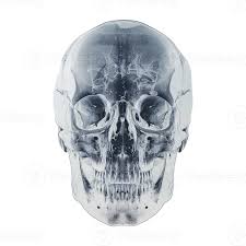 Image result for Skull XRay