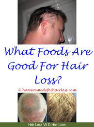 Hair Growth Surgery Help Hair Loss Hair Loss Solutions Treat Hair Loss
