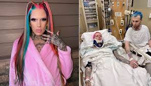 The youtube star and beauty influencer says he was in a severe. Notknr 4pdv Pm
