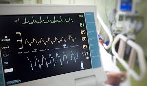 Melakukan tindakan untuk mencegah terjadinya kematian atau cacat. Pasien Monitor Pengertian Fungsi Parameternya Jenisnya