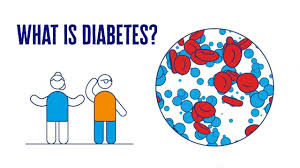 Strive for variety to prevent boredom. What Is Diabetes Getting To Know The Basics Diabetes Uk