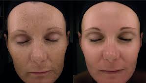 Role of skin-imaging systems in modern aesthetic practice