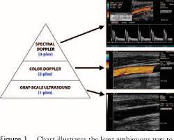 Doppler Us Of The Liver Made Simple 1 Cme Semantic Scholar