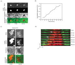 Mesothelial cells also have microvilli . Ovarian Cancer Spheroids Use Myosin Generated Force To Clear The Mesothelium Abstract Europe Pmc