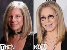Barbra Streisand Plastic Surgery Bad Celebrity Plastic Surgery Plastic Surgery Celebrity Plastic Surgery