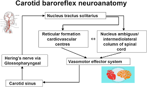 Frontiers Should We Ever Pace For Carotid Sinus Syndrome Cardiovascular Medicine