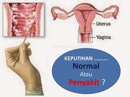 Keputihan yang ada dimulut rahim beserta sekar malam bisa keluar dengan sendirinya, juga dapat dikeluarkan sendiri dengan mengirim pesan customer service kami tersebut maka bunda secara otomatis mendapatkan bonus. Ubat Keputihan Secara Tradisional Berubat D
