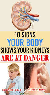 Kidneys These Are One Of The Most Important Organs In Our Body That Involves Thousand Of Functions They Will Help To F Women Health Care Health Skin Symptoms