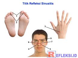 Titik Refleksi Untuk Mengobati Sinusitis Pada Telapak Kaki Dan Tangan Titik Akupresur Pilek Akupresur Sistem Tubuh Manusia Refleksiologi