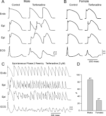 Now this is the next tale, and it tells how the camel got his big hump. Brugada Syndrome Antzelevitch 2006 Pacing And Clinical Electrophysiology Wiley Online Library