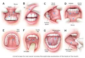 Some of its most common symptoms include a persistent sore throat and/or cough, difficulty swallowing, hoarseness, ear pain and a neck mass. What Causes Throat Cancer Nhs