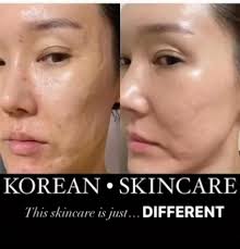 Life too short for plain skin… ink your story 🖤✨ Your skin deserves art  too 🔥📍Glow Haven 📞 08107616171 Elepe| ikorodu