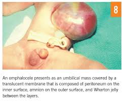 Image result for Umbilicus botryoides