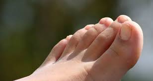 Resultado de imagen para dedos del pie