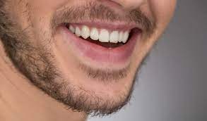 Facial hair growth is a phenomena experienced by many women across the world. What Is The Awkward Beard Phase And How To Overcome It