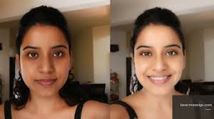 Black And White Bleaching Cream Results Pin On Skin Care Treatments