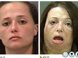Meth use can ravage people's faces and bodies so badly that they become almost unrecognizable. New Faces Of Meth Ads Are Utterly Harrowing