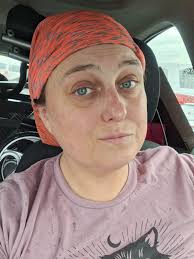 Overcoming challenges with autoimmune disease