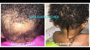 Updated on march 30, 2010. Natural Hair Journey Baby Toddler Natural Hair Care Tips L Baby Bald Spot Youtube