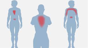 Angina Pectoris Herzenge